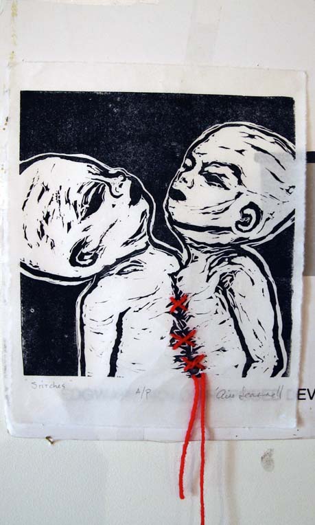 Stitches by Aine Scannell